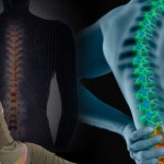 Spinal rehabilitation
